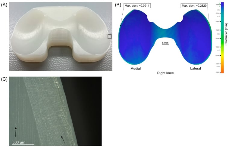 Three panels (A-C): a retrieved tibial insert, its optical penetration map labelled medial, lateral and right knee with a 5 mm scale bar, and microscopy of parallel machining marks at arrows with a 500 μm scale bar.