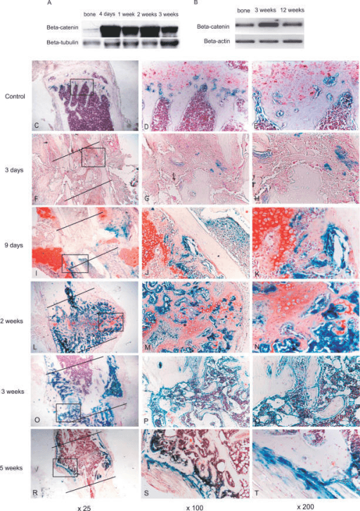 Clinical image for Fracture Healing Biology