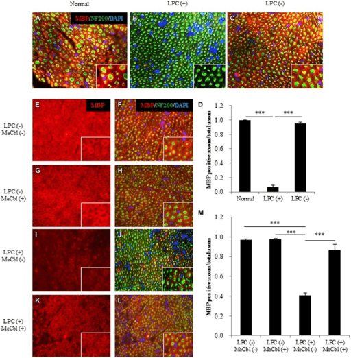 Clinical image for Peripheral Nerve Injury and Regeneration