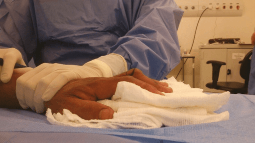 Clinical photographs demonstrating two common extensor tendon injuries. Left: Mallet finger with DIP flexion deformity at rest and inability to actively extend DIP. Right: Boutonniere deformity with fixed PIP flexion and DIP hyperextension. Both require specific splinting protocols. Mallet finger: DIP extension splint 6-8 weeks. Boutonniere: PIP extension splint allowing DIP flexion.
