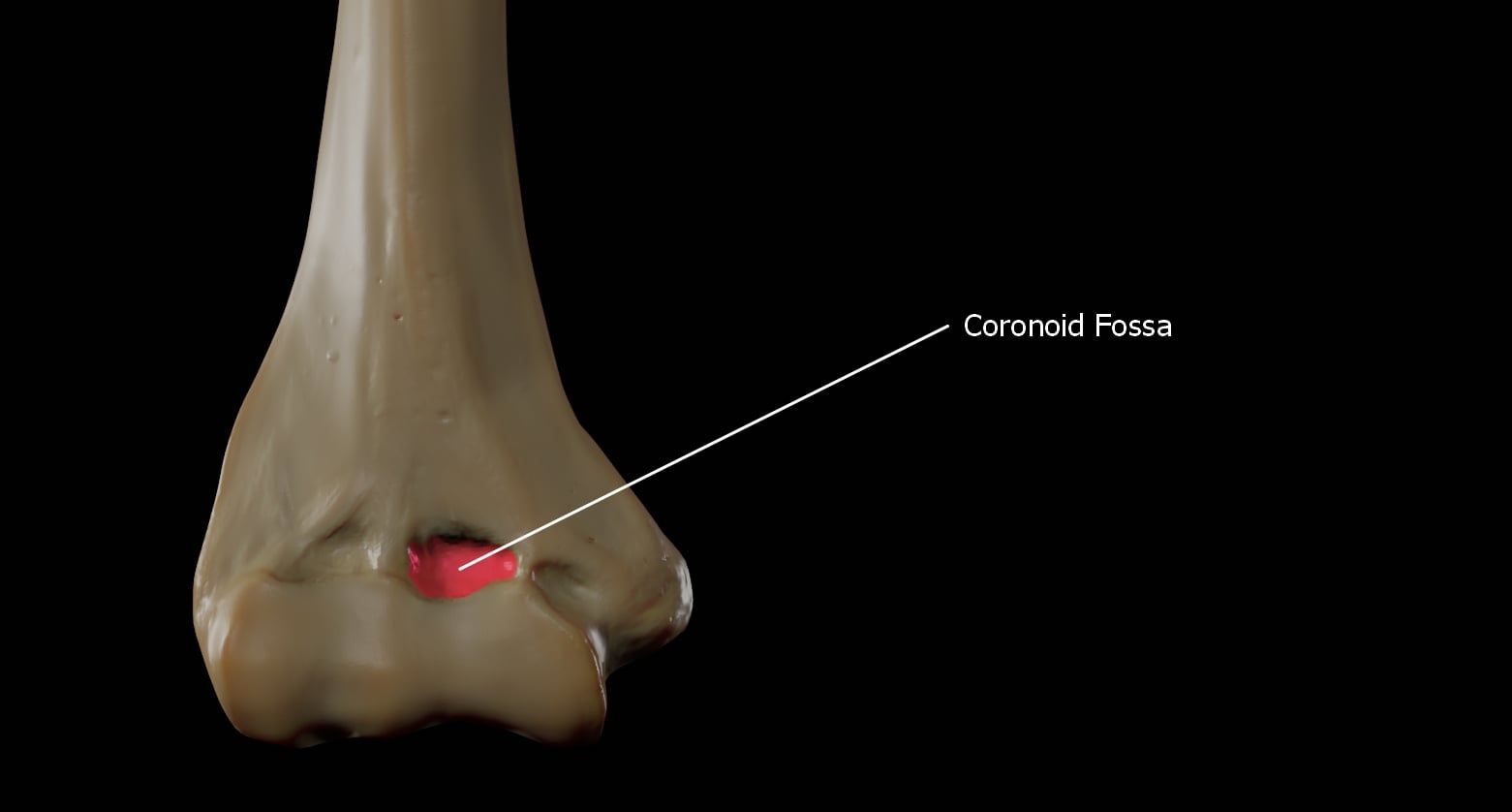 Anterior view of the distal humerus (coronoid fossa highlighted) β the anterior metadiaphyseal surface exposed for plating in the anterolateral approach to the distal third.