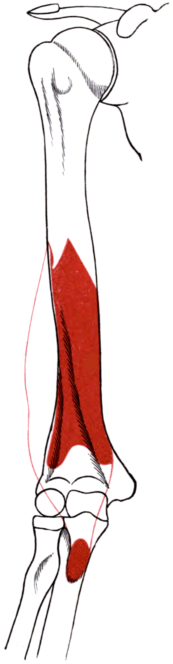 Schematic of the brachialis muscle arising from the broad anterior surface of the distal humeral shaft and inserting on the ulna — the muscle split longitudinally in the approach.