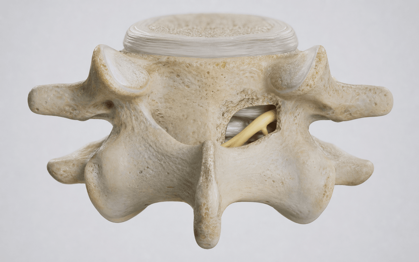 Cervical neural foramen and exiting nerve root