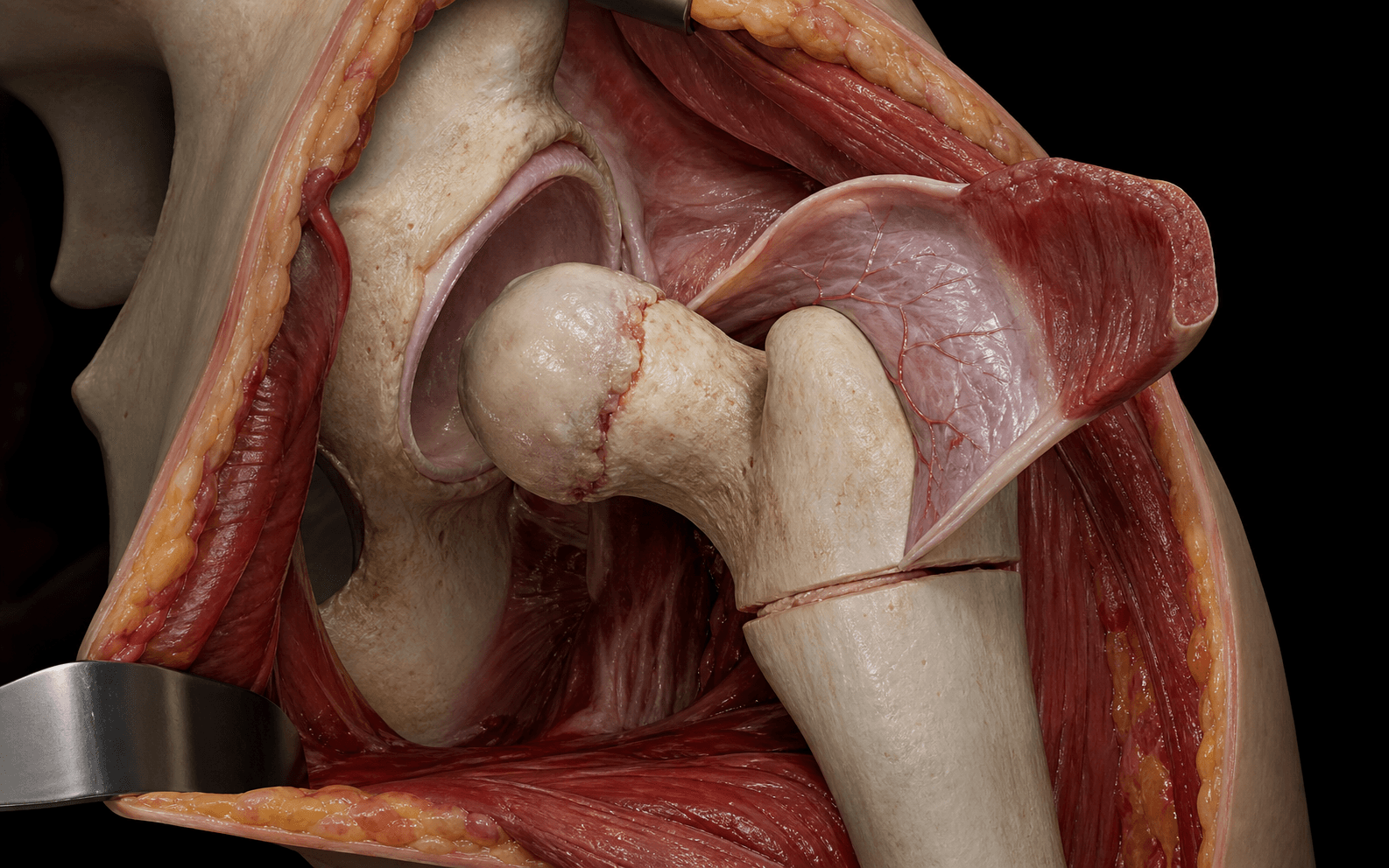 Modified Dunn procedure