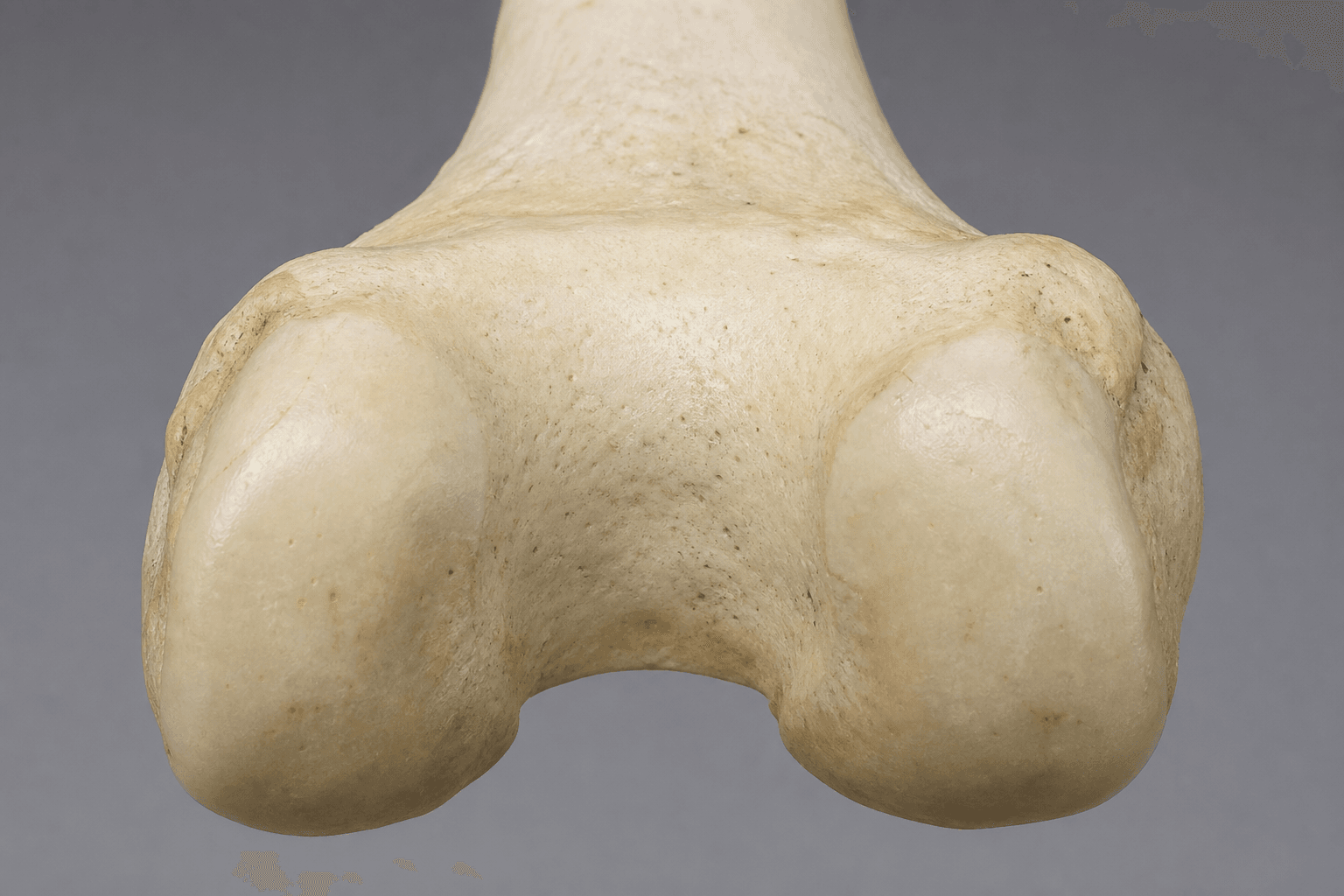 Femoral trochlea anatomy