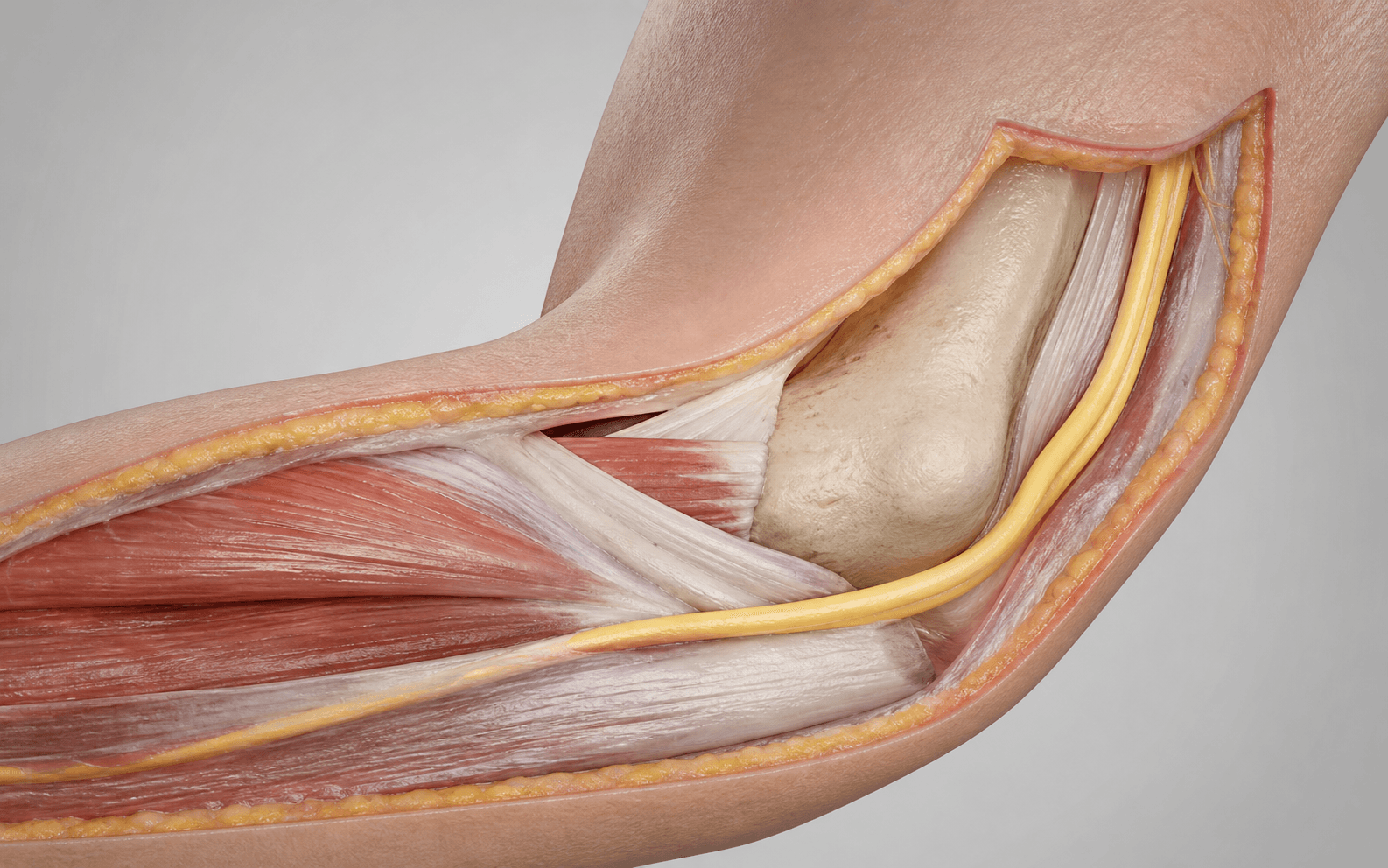 Ulnar nerve at the cubital tunnel
