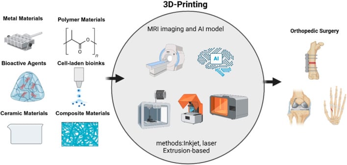 Comprehensive overview of 3D printing in orthopaedic surgery