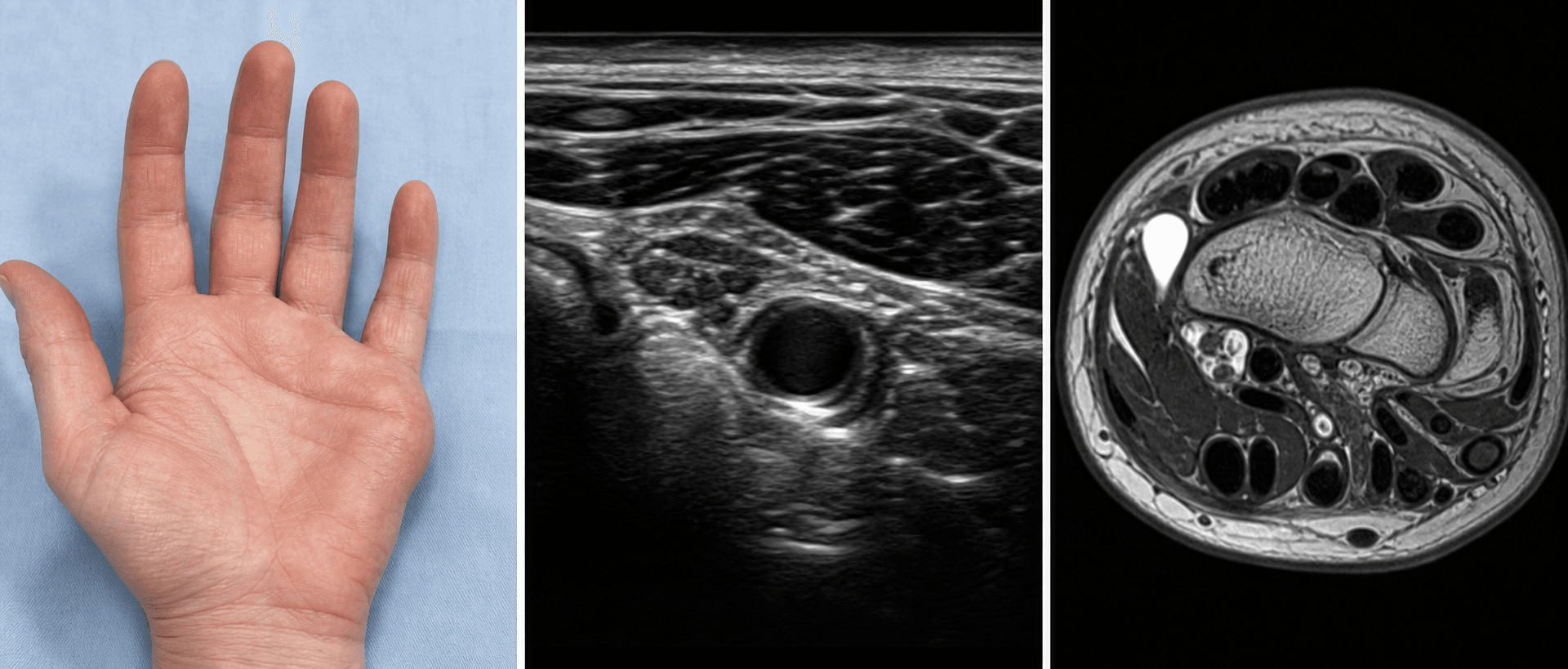 Abductor digiti minimi visual summary for Clinical Imaging