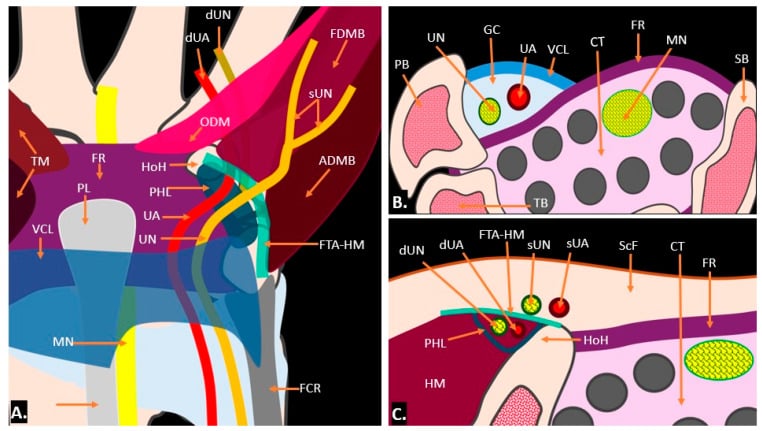 Anatomical illustration of Guyon's canal and hypothenar muscles