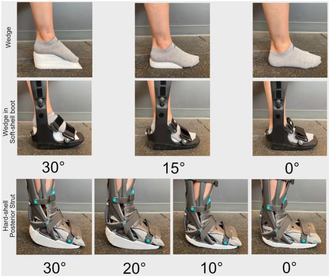 Soft-shell wedge and hard-shell wedge immobilising boots with stacked heel wedges used to position the ankle in plantarflexion during Achilles rehabilitation