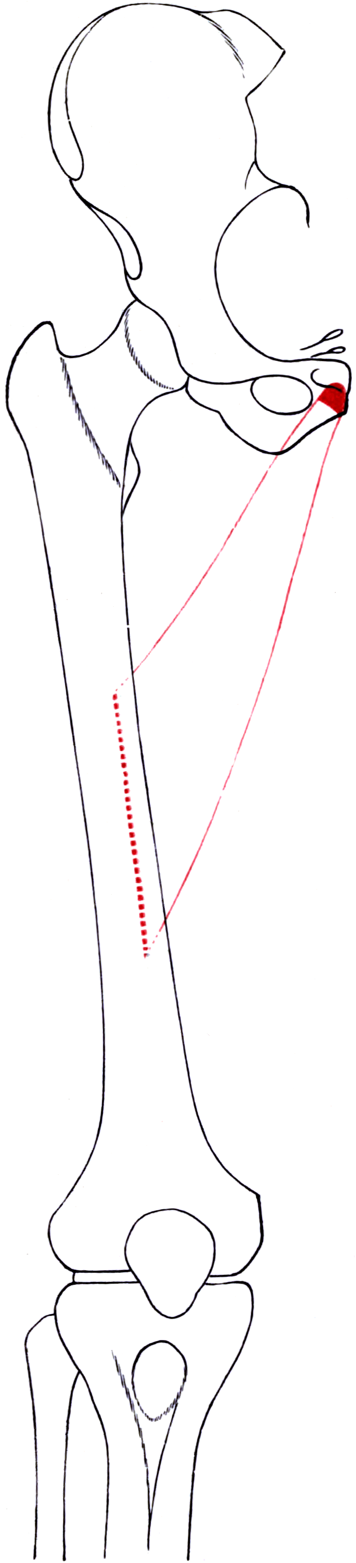 Outline drawing of the right femur and hip bone with the attachment areas of adductor longus shaded.