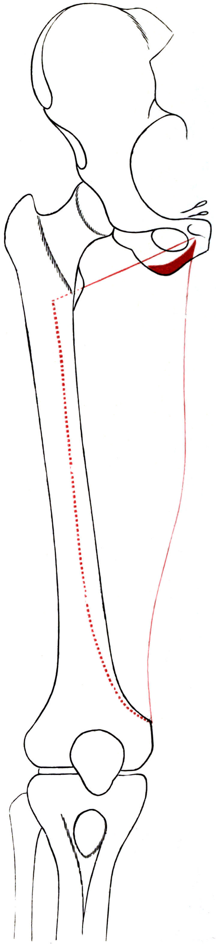Outline drawing of the right femur and hip bone with the attachment areas of adductor magnus shaded.