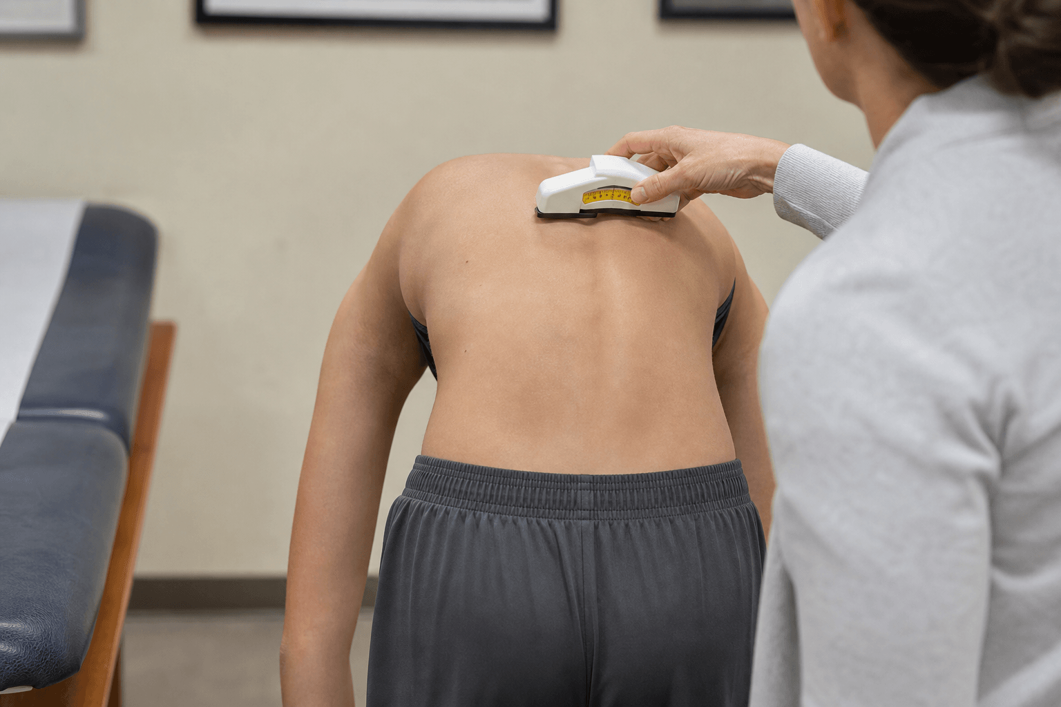 Adams forward bend test with scoliometer over thoracic rib prominence