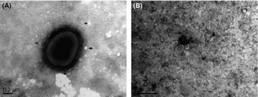 Transmission electron micrograph of a single Pasteurella multocida coccobacillus with surrounding capsule.