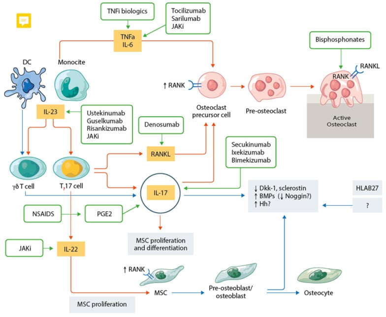 Cellular pathway diagram of osteoclast-mediated erosion and osteoblast-mediated new bone formation in spondyloarthritis