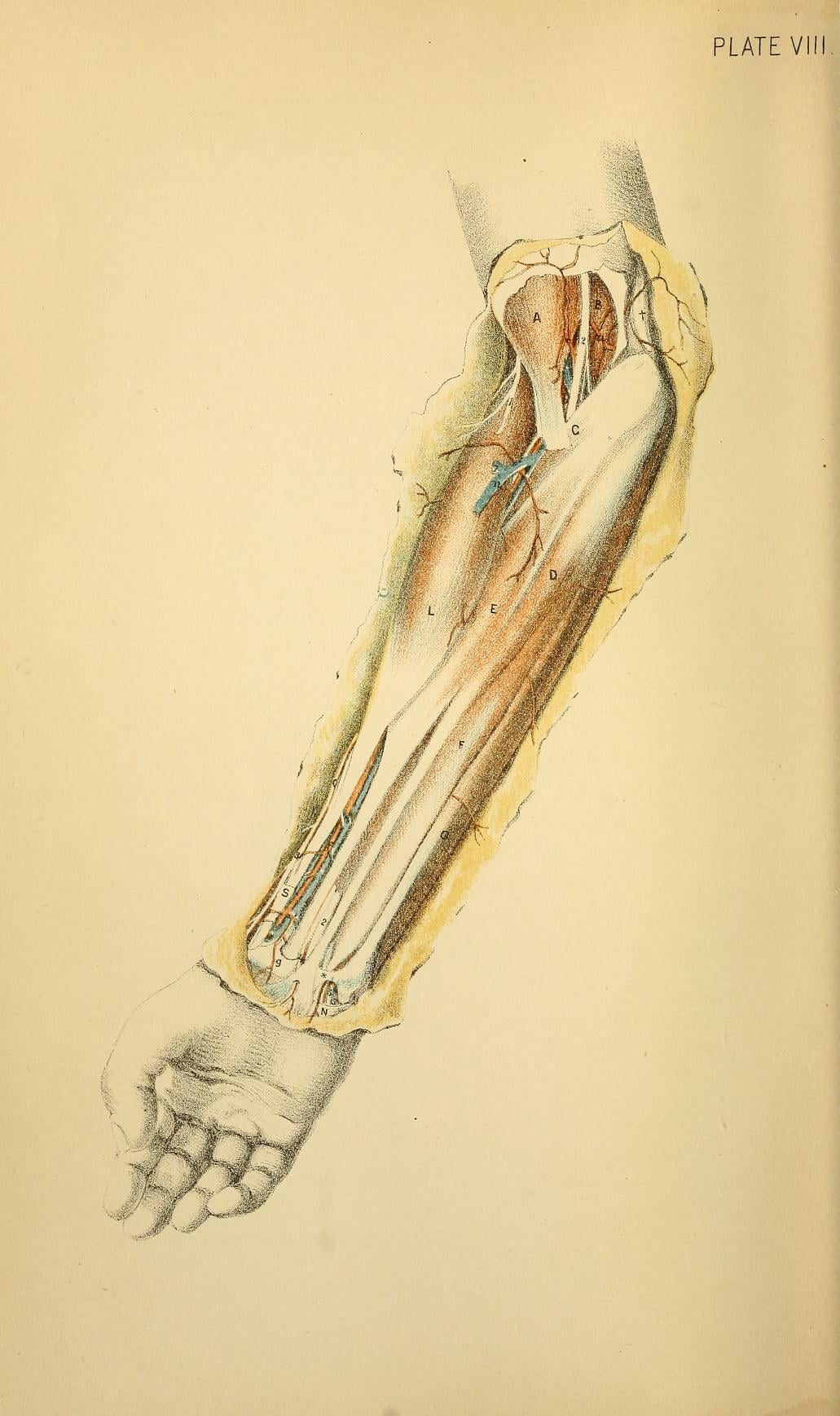 Dissection of the forearm showing superficial anatomy with muscles, radial artery and median nerve