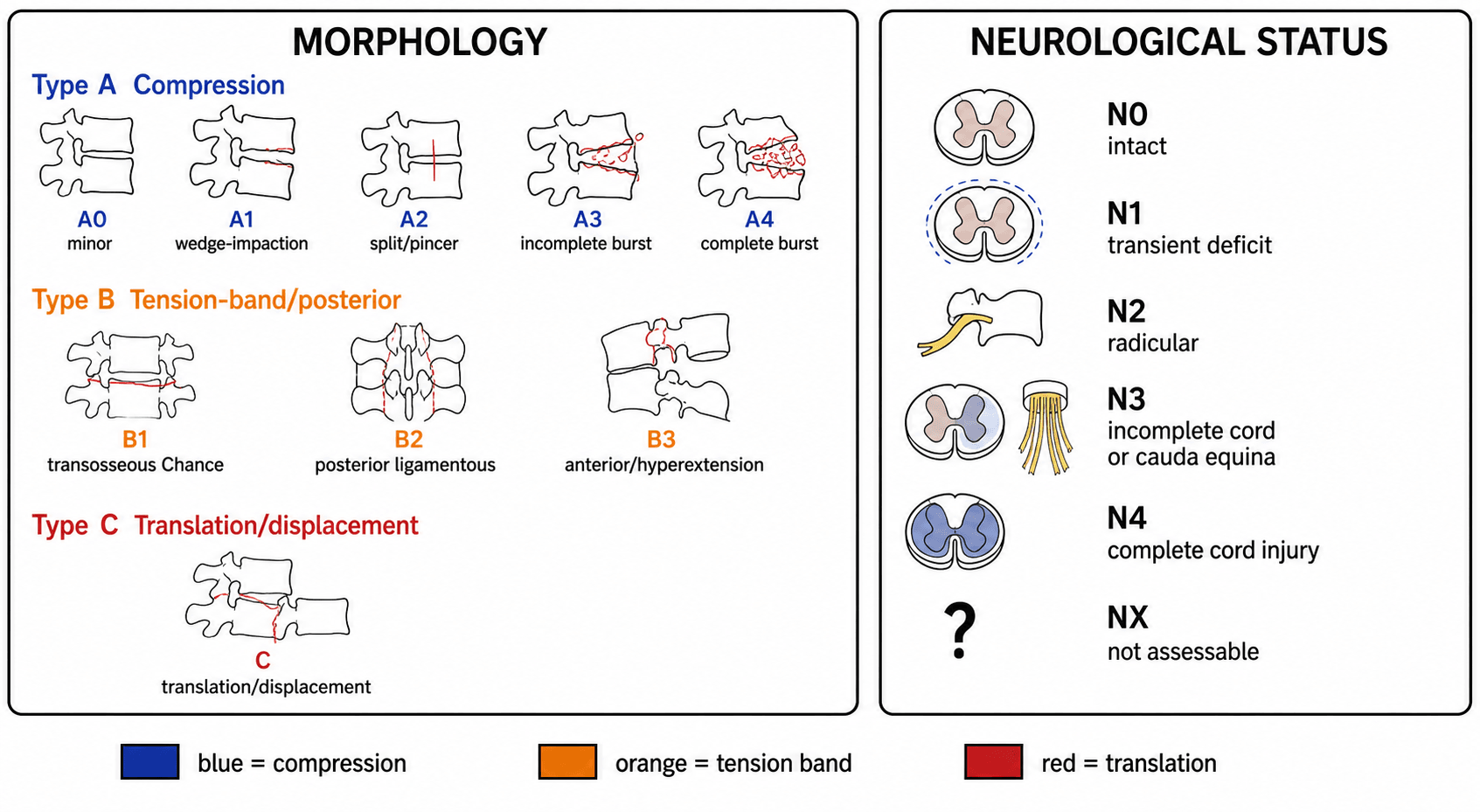 AO Spine thoracolumbar injury classification: morphology (Type A compression A0-A4, Type B tension-band B1-B3, Type C translation) and neurological status N0-N4/NX