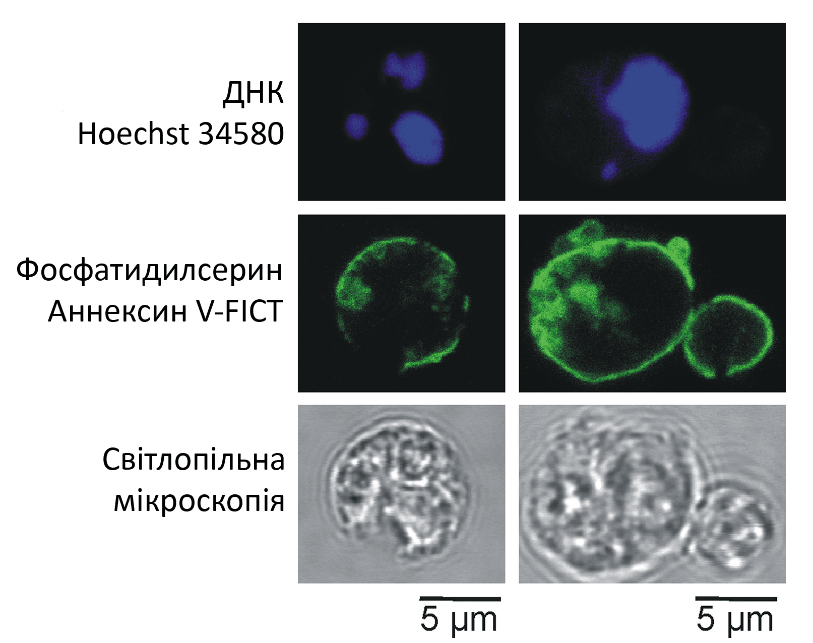 Fluorescence microscopy panels of apoptotic cells stained with Hoechst for DNA and Annexin V-FITC for surface phosphatidylserine