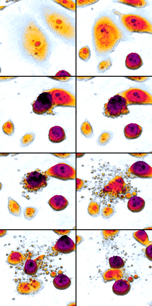 Time-lapse microscopy mosaic of cells undergoing apoptosis with progressive shrinkage, blebbing and fragmentation