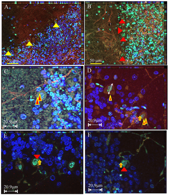 Triple fluorescent labelling of tissue showing TUNEL-positive cells, active caspase-3 immunoreactivity and DAPI nuclear staining