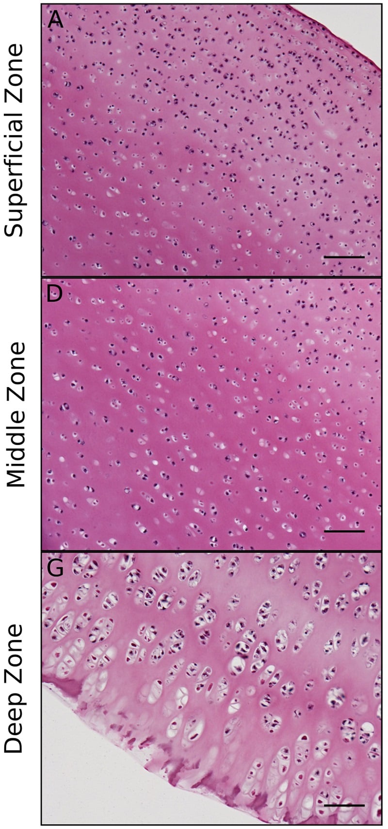 Histological sections showing the three zones of articular cartilage