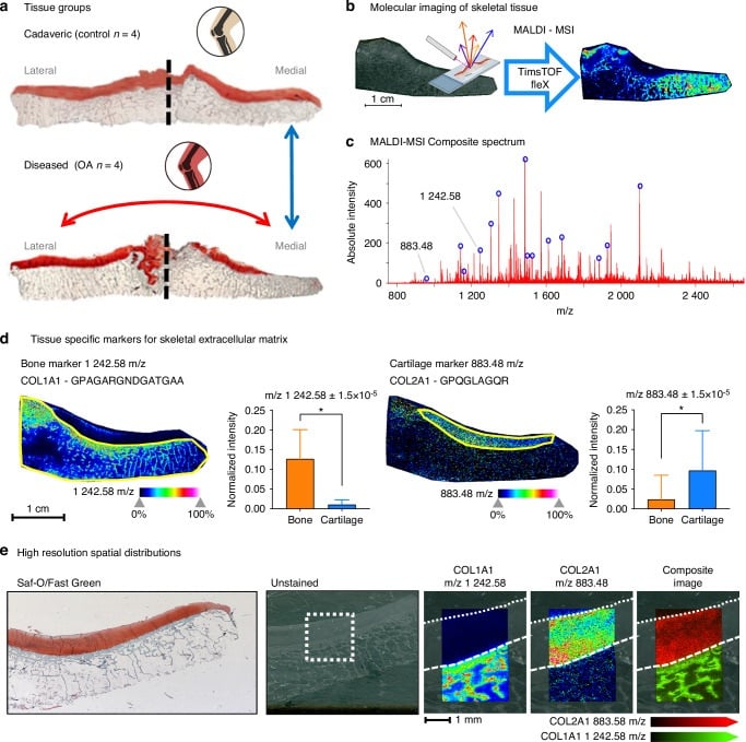 Human tibial plateau histology and molecular maps comparing non-arthritic and osteoarthritic tissue