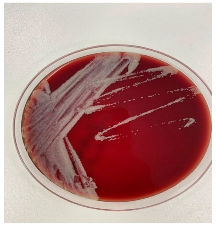 A blood agar plate with pale, opaque Mycobacterium fortuitum colonies