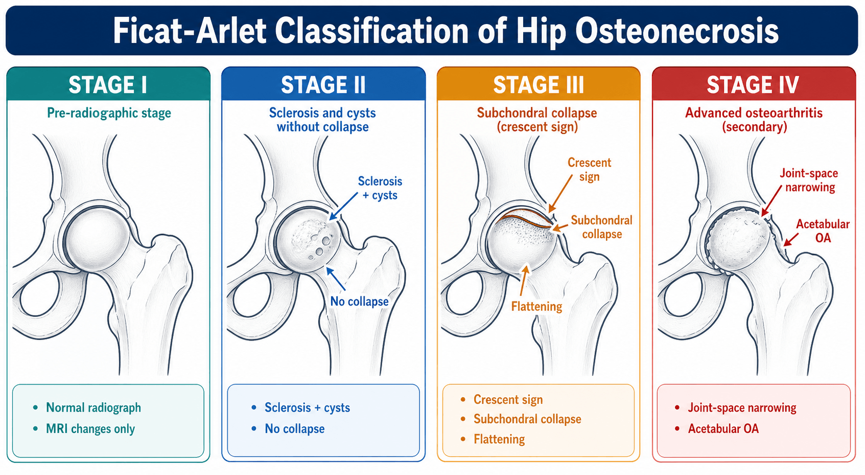 Ficat-Arlet classification of hip osteonecrosis