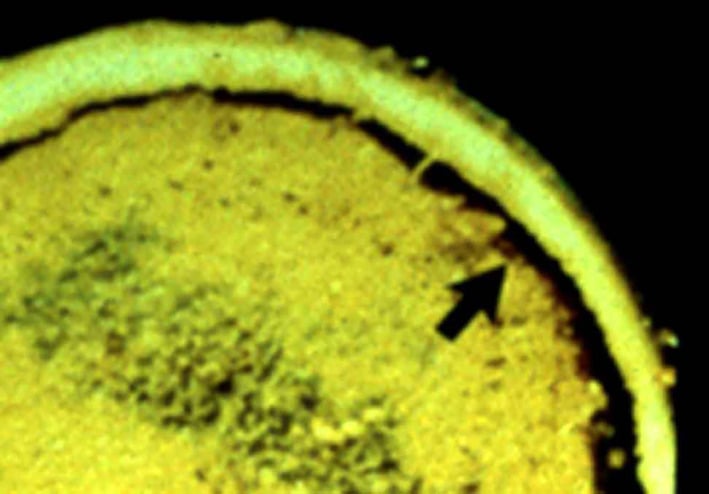 Sectioned specimen of an osteonecrotic head with an arrow marking a subchondral fracture