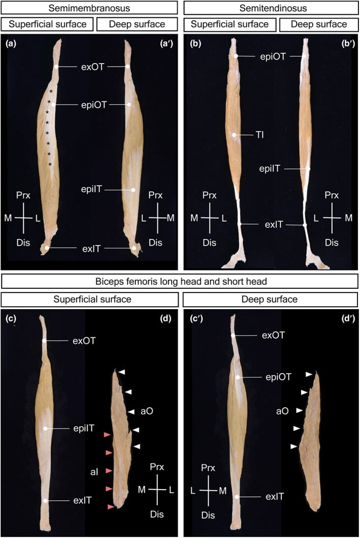 Cadaveric isolated hamstring specimens showing the superficial and deep surfaces of semimembranosus, semitendinosus, biceps femoris long head and biceps femoris short head