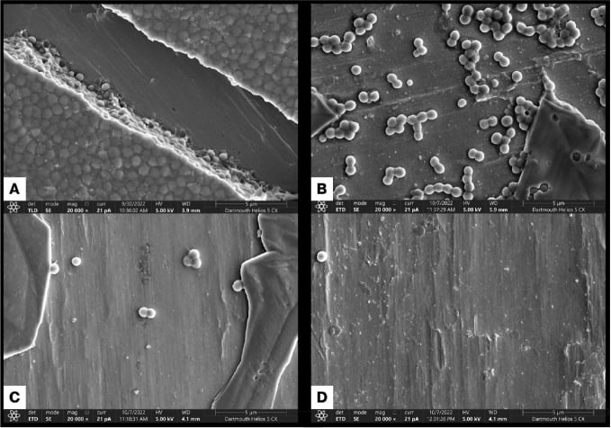 Scanning electron micrograph of Staphylococcus aureus biofilm on cobalt-chromium alloy