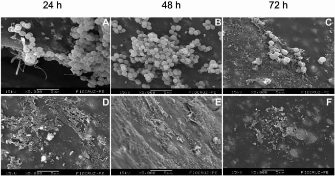 Scanning electron micrographs of Staphylococcus epidermidis biofilm growth over 72 hours