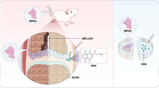 Schematic of periprosthetic joint infection showing MRSA biofilm on orthopaedic implant