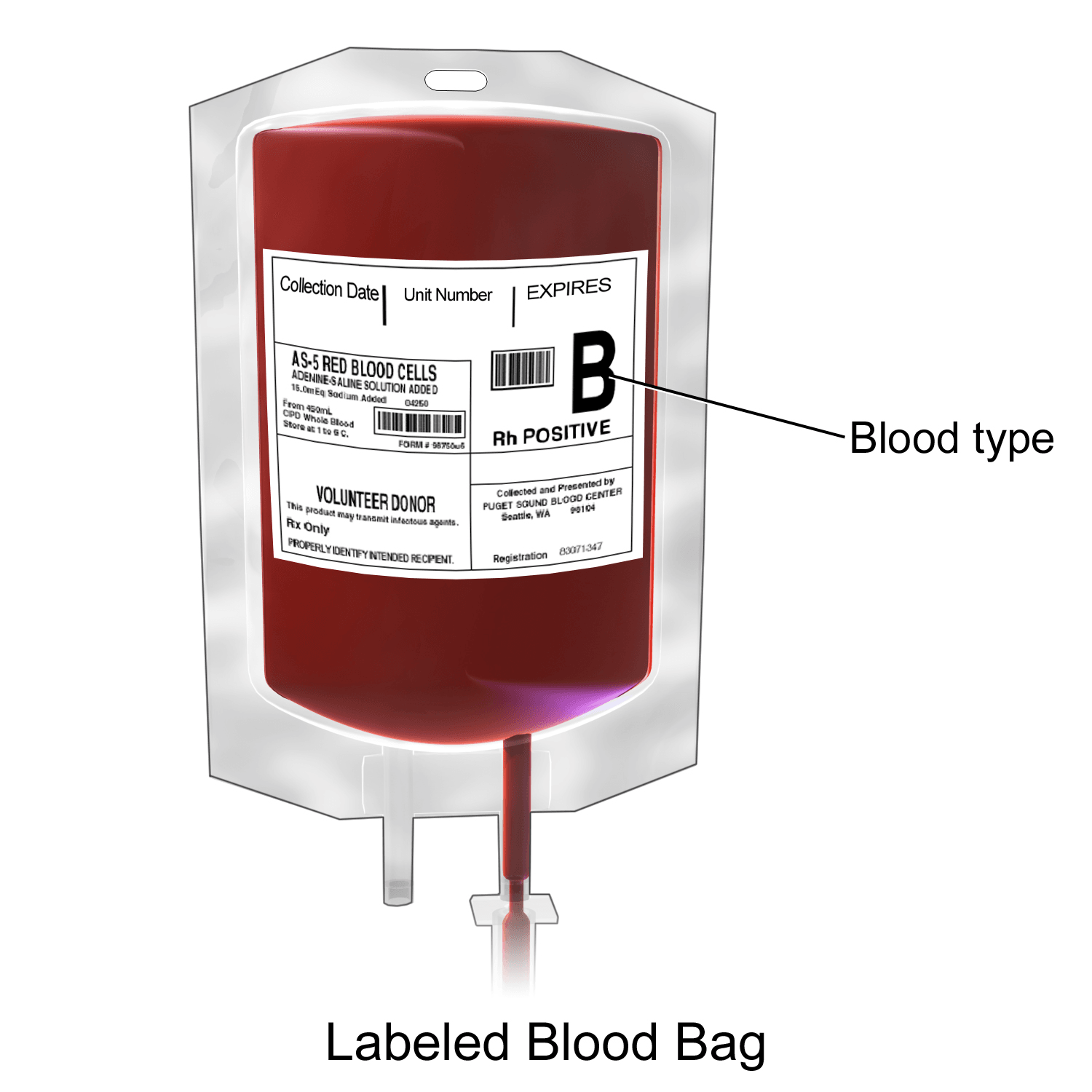 Labeled blood bag containing packed red blood cells for transfusion
