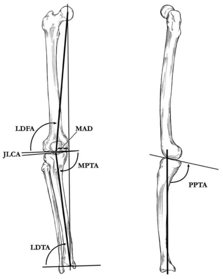Coronal and sagittal deformity analysis