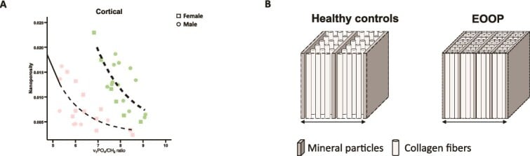 Schematic comparing healthy and osteogenesis imperfecta bone nanostructure