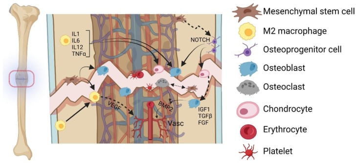Cellular components contributing to bone healing including MSCs, osteoblasts, osteoclasts, and macrophages