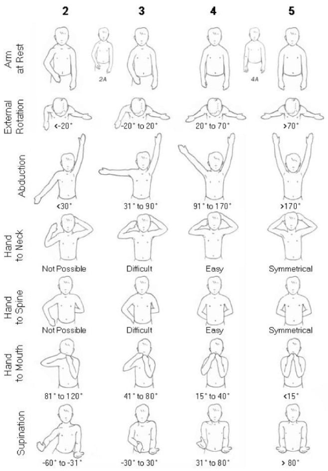 Illustration of the Mallet score grading shoulder function from grade 2 to grade 5