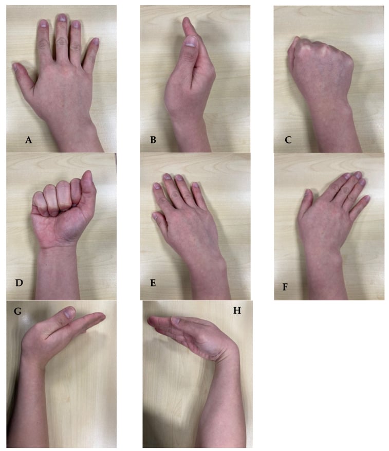 Eight clinical wrist positions used for neutral, lateral, clenched-fist, deviation, flexion and extension stress radiographs.