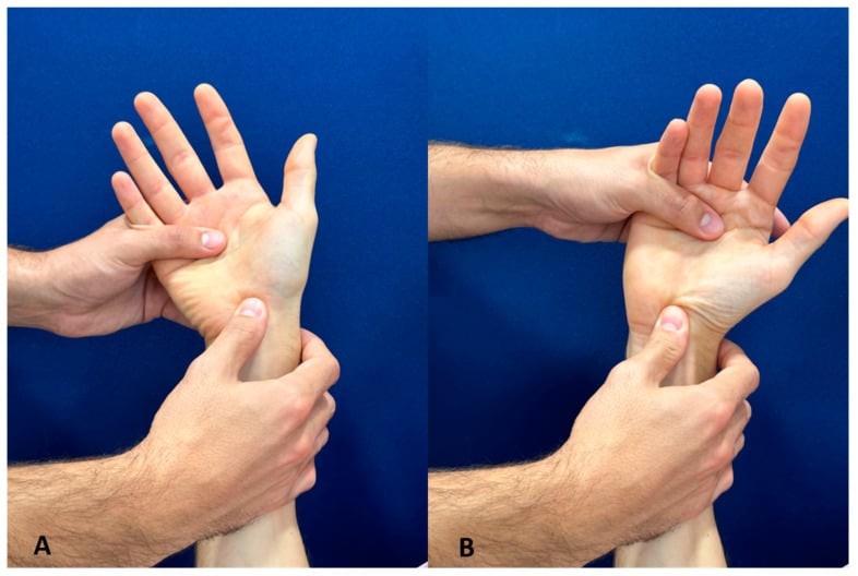 Two clinical photographs demonstrating examiner hand placement and wrist motion for the Watson scaphoid shift test.