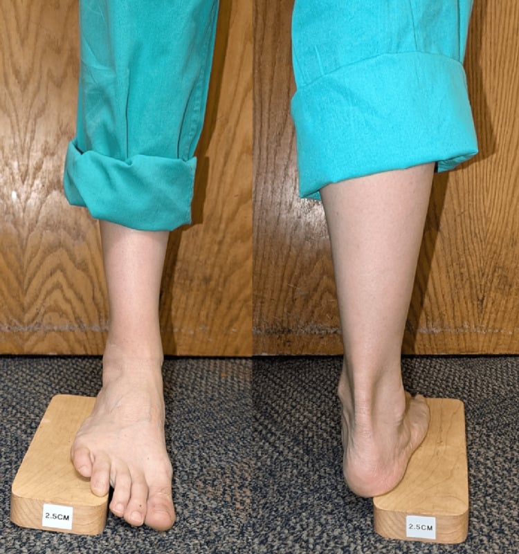 Anterior and posterior views of the Coleman block test with a wooden block under the lateral foot and the first metatarsal hanging free