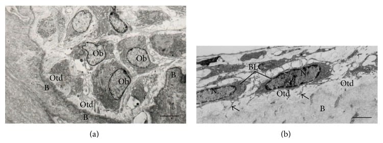 Transmission electron micrographs comparing active osteoblasts rich in rough endoplasmic reticulum with a flattened bone-lining cell.