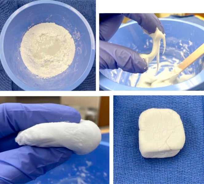 Four-panel sequence showing bone cement during mixing, sticky, working and hardening phases.