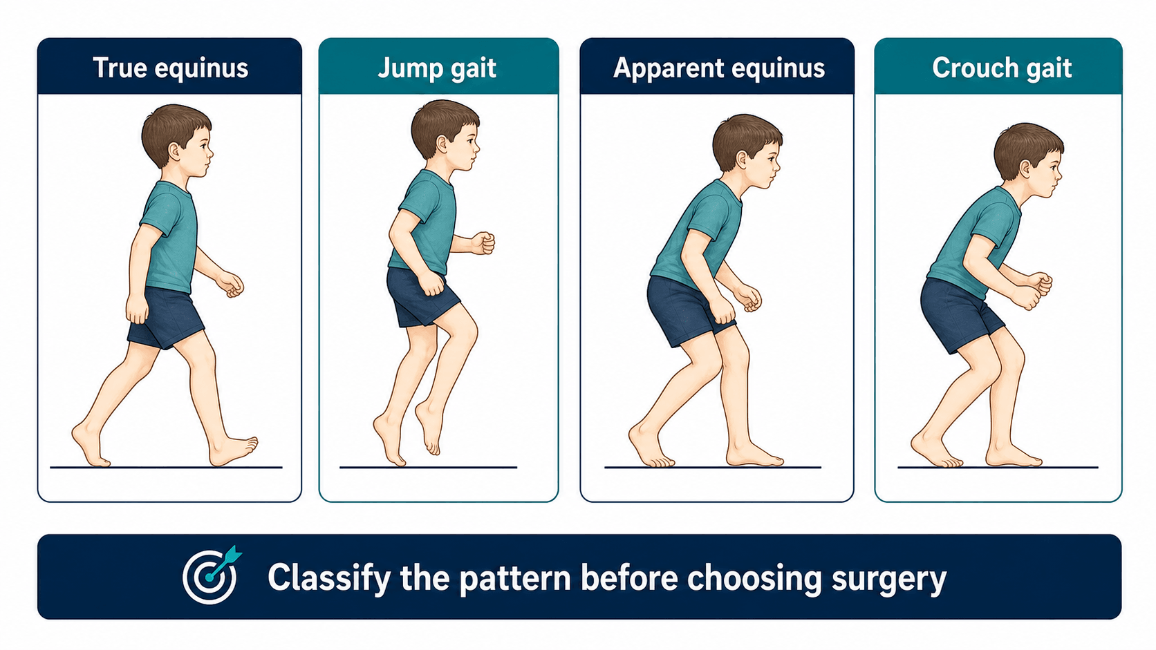 Cerebral palsy sagittal gait patterns showing true equinus, jump gait, apparent equinus and crouch gait