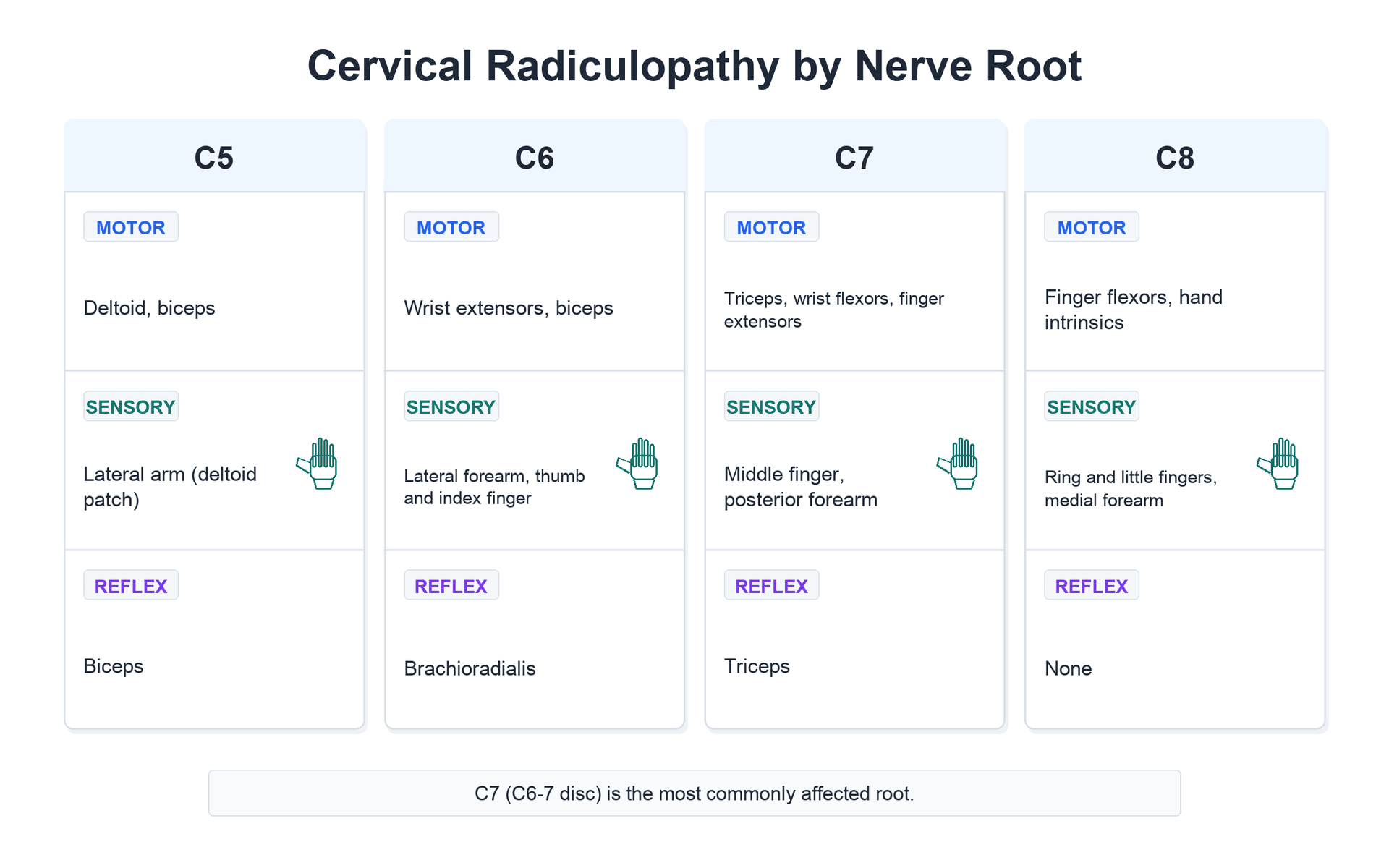 Chart of cervical radiculopathy by nerve root (C5 to C8) listing the motor, sensory and reflex findings for each.