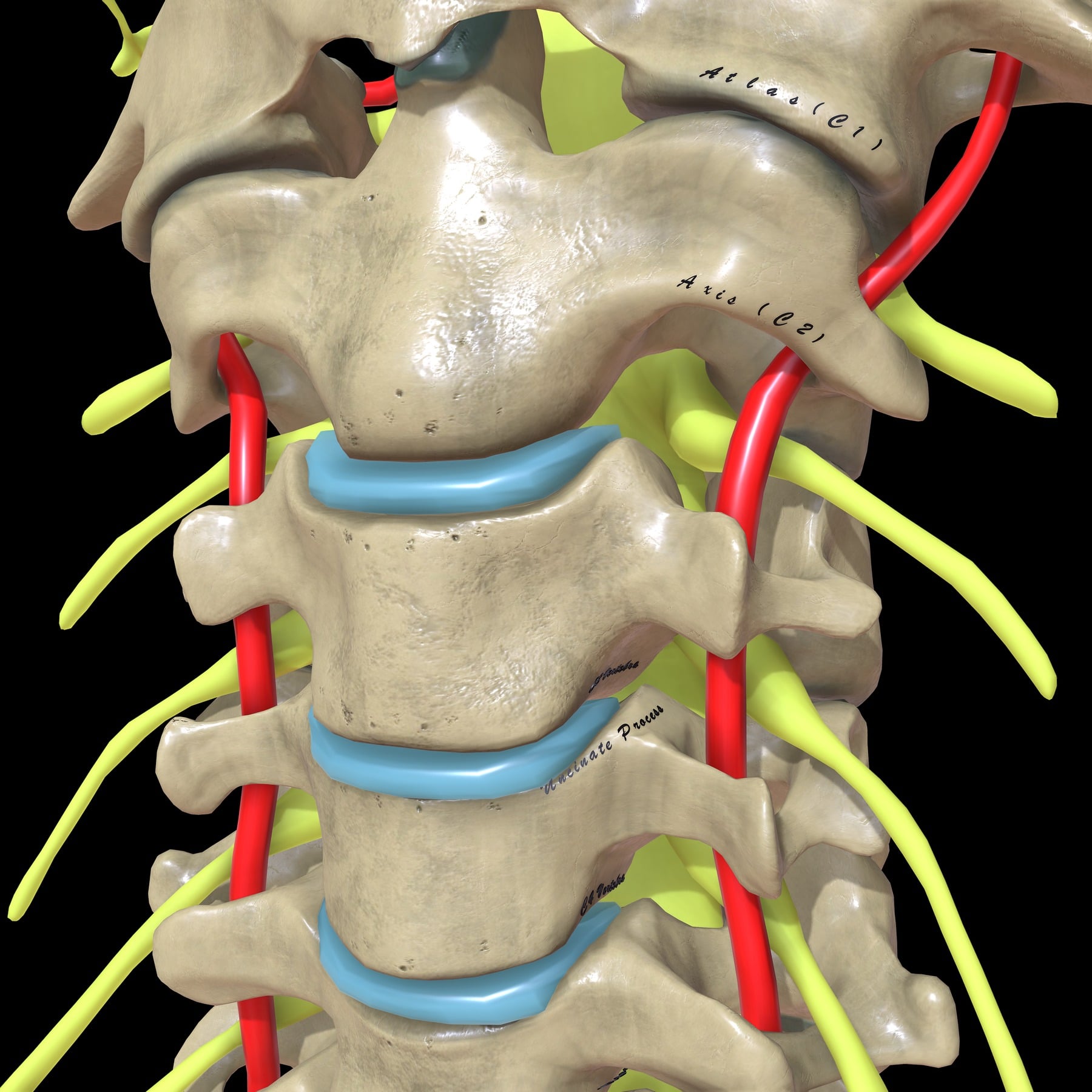 Computer-generated posterior cervical anatomy showing vertebral arteries and cervical spinal nerves