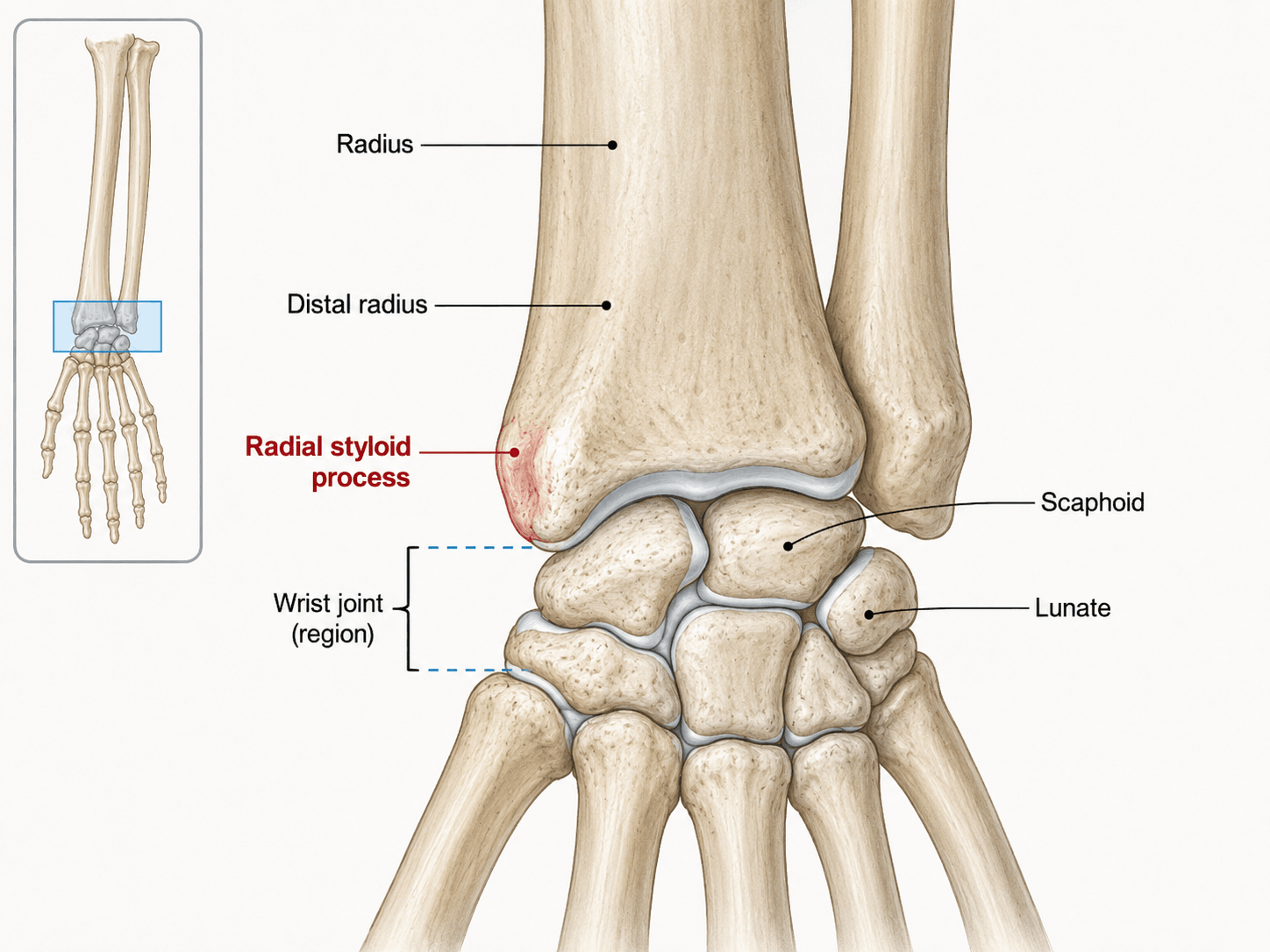 Labelled diagram of the distal radius showing the radial styloid process, scaphoid and lunate.