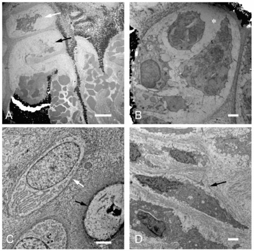Transmission electron micrographs of chondrocytes within their lacunae