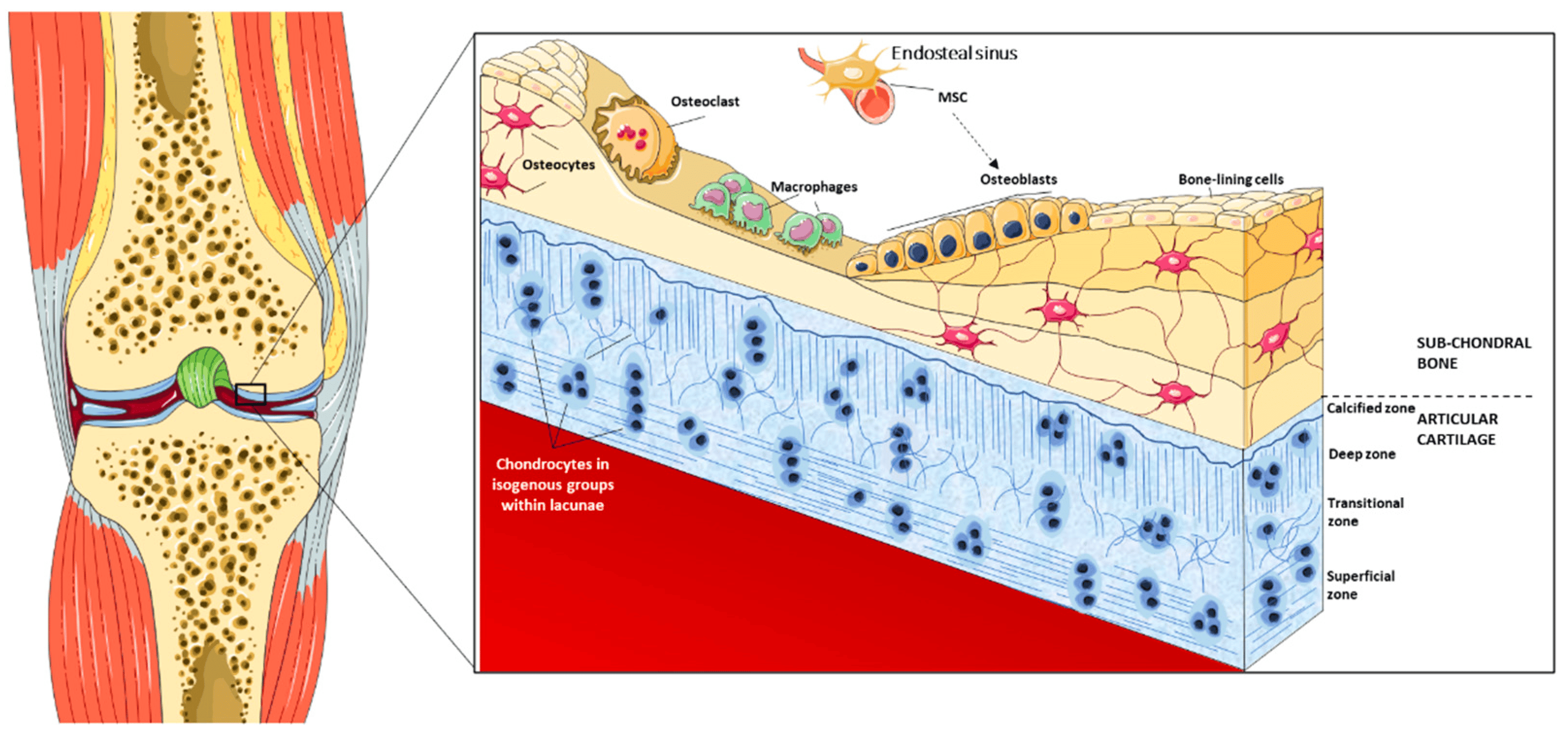 Schematic of the osteochondral unit showing cartilage zones over subchondral bone