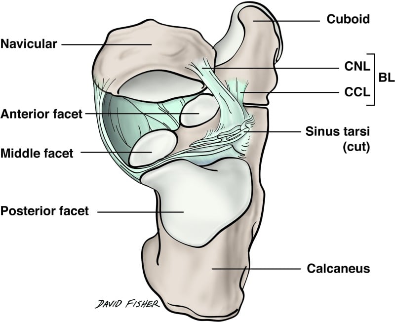 Superior anatomical illustration of the bifurcate ligament dividing into calcaneonavicular and calcaneocuboid limbs